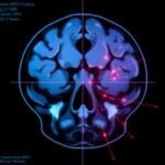 How AI is Shaking Up Cancer Detection in Radiology – Insights from a Game-Changing Meta-Analysis