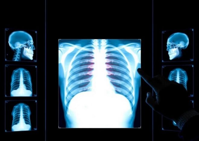 Is AI Really Ready to Read Your X-Rays? Insights from a Teesside Study